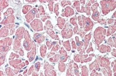 Immunohistochemistry-Paraffin: SLITRK6 Antibody [NBP3-14476]